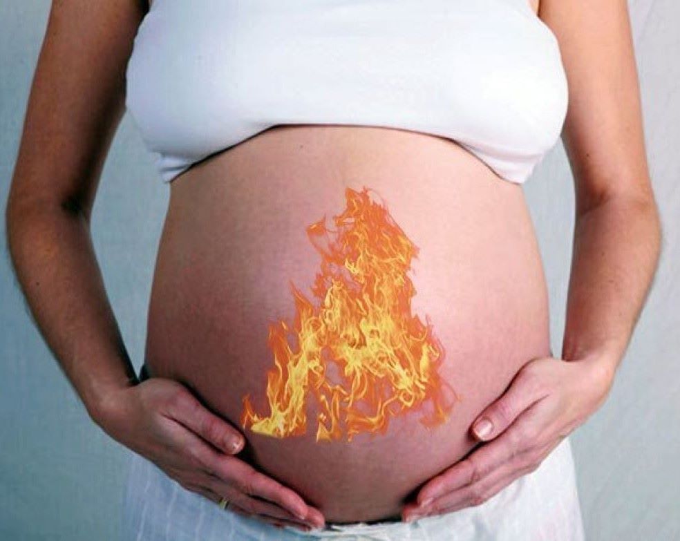 Изжога во втором триместре. Изжога у беременных. Изжоге прибеременночти. Изжога беременность 3 триместр.